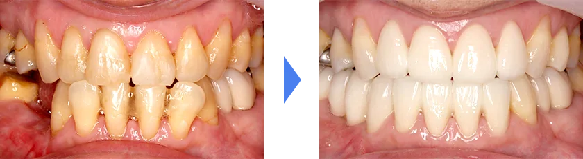歯と歯並びをキレイにしたい